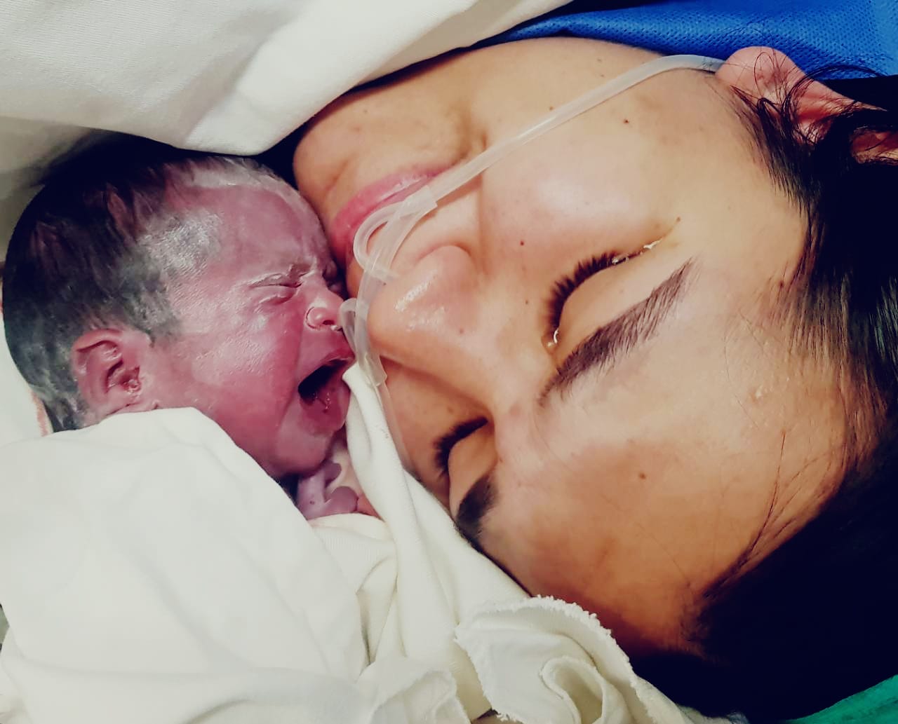 Iris Milena fue intervenida en el vientre materno a las 26 semanas y media de gestación. Foto: @IPSParaguay