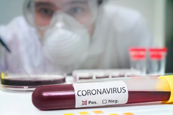 La paciente estuvo en terapia intensiva desde el sábado en el INERAM. Se confirma su fallecimiento por Covid-19. Foto Ilustración / www.mejorconsalud.com