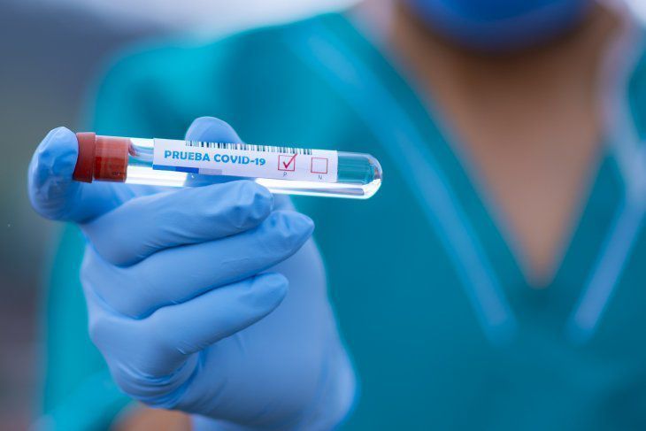 Autoridades sanitarias pretenden alcanzar las 5.000 muestras diarias. Foto referencial.