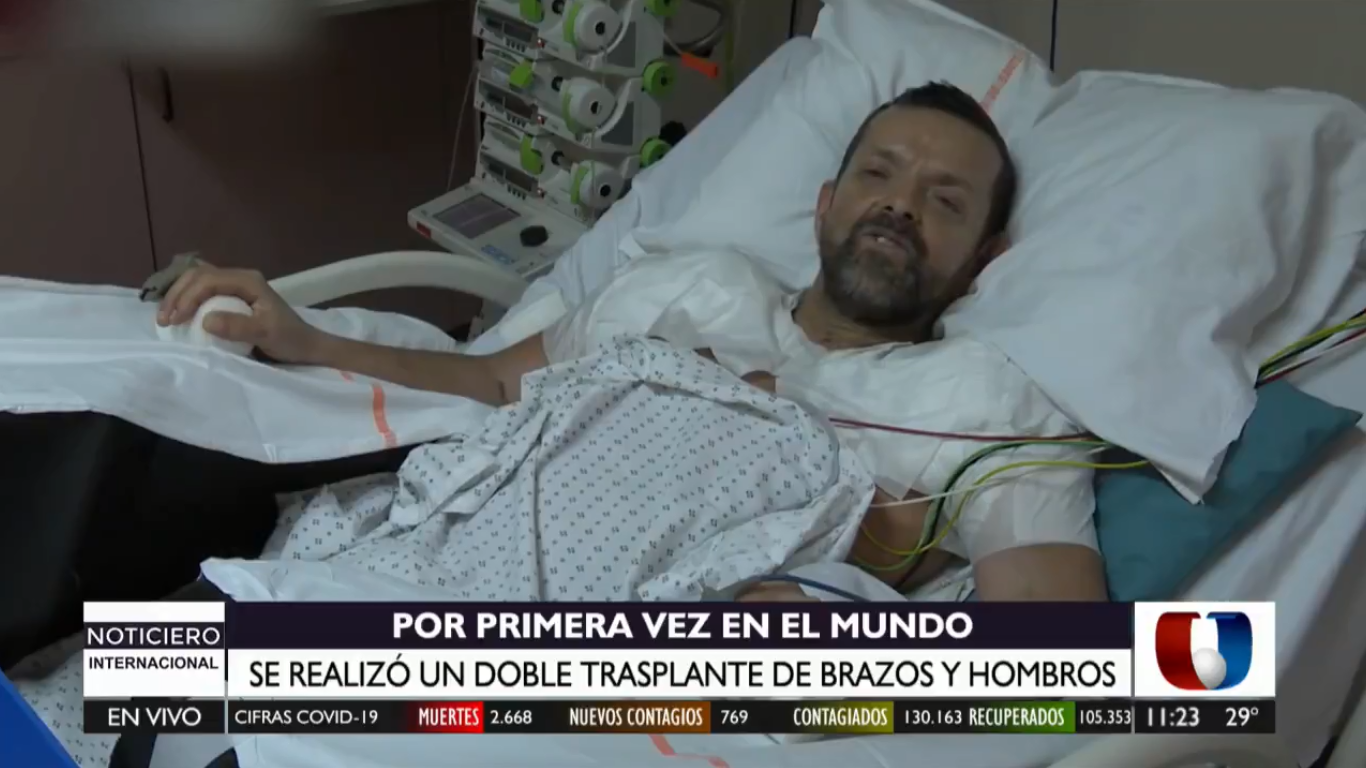 Francia realiza doble trasplante de brazos y hombros