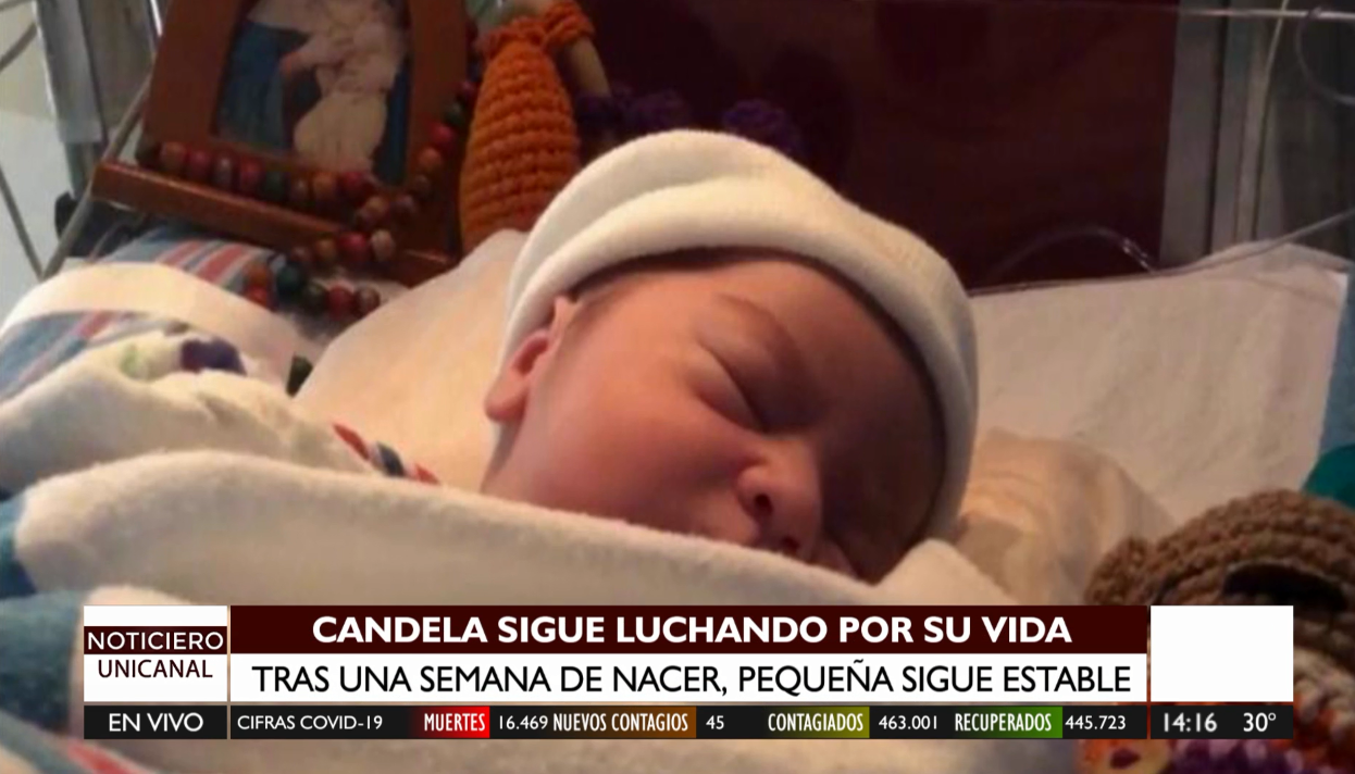 Candela sigue luchando por su vida: la bebé sigue estable, reportaron