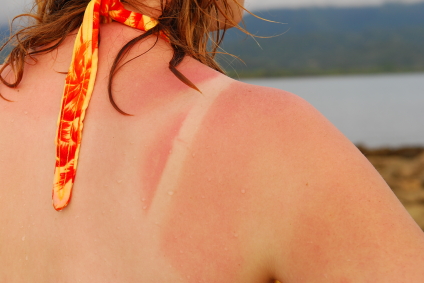 Salud recomienda proteger la piel durante el verano ante los rayos UV. Foto: Agencia IP.