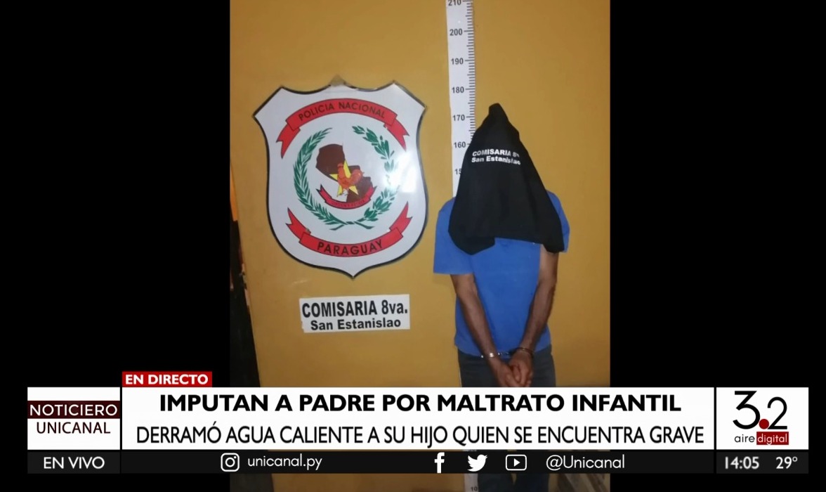 San Pedro: padre derramó agua caliente a su propio hijo de 3 años