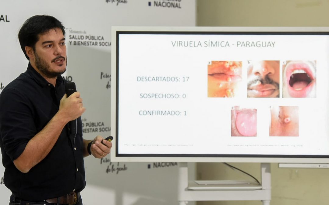 Primer caso de viruela del mono en Paraguay: Paciente vino de Brasil y se encuentra estable, mencionó Salud
