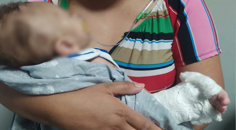 Otra denuncia de mala praxis contra IPS: Bebé sufrió fractura en la pierna tras revisión médica